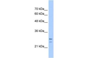 Western Blotting (WB) image for anti-Signal Recognition Particle Receptor, B Subunit (SRPRB) antibody (ABIN2463283) (SRPRB Antikörper)