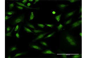 Immunofluorescence of monoclonal antibody to PRKCD on HeLa cell. (PKC delta Antikörper  (AA 577-676))