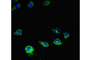 Immunofluorescent analysis of Hela cells using ABIN7169076 at dilution of 1:100 and Alexa Fluor 488-congugated AffiniPure Goat Anti-Rabbit IgG(H+L) (MTOR Antikörper  (AA 1223-1290))