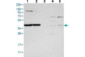 Western blot analysis of Lane 1: RT-4, Lane 2: U-251 MG, Lane 3: Human Plasma, Lane 4: Liver, Lane 5: Tonsil with MRPL37 polyclonal antibody . (MRPL37 Antikörper)