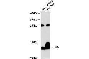 Western blot analysis of extracts of various cell lines, using HBD antibody (ABIN6132879, ABIN6141642, ABIN6141643 and ABIN6224938) at 1:3000 dilution.