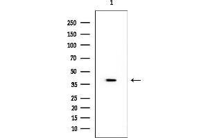 anti-Non Imprinted in Prader-Willi/Angelman Syndrome 2 (NIPA2) antibody
