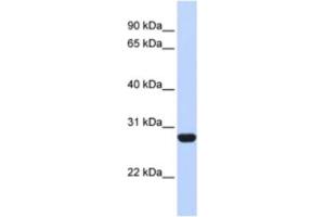 Western Blotting (WB) image for anti-Ribosomal Protein L13 (RPL13) antibody (ABIN2462055) (RPL13 Antikörper)