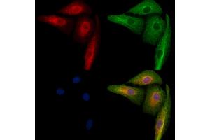 ABIN6259719 and ABIN6279066 staining  cells by IF/ICC. (ACBD5 Antikörper  (Internal Region))