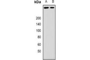 Western blot analysis of ANKHD1 expression in mouse brain (A), rat brain (B) whole cell lysates. (ANKHD1 Antikörper)