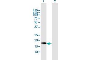 Western Blot analysis of ZNF576 expression in transfected 293T cell line by ZNF576 MaxPab polyclonal antibody. (ZNF576 Antikörper  (AA 1-170))