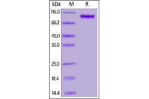 Biotinylated Human / Cynomolgus / Rhesus macaque ROR1, Fc,Avitag on  under reducing (R) condition. (ROR1 Protein (AA 30-403) (Fc Tag,AVI tag,Biotin))