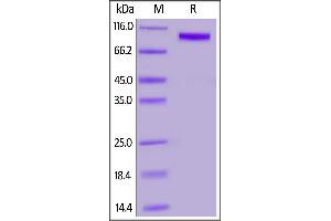 SDS-PAGE (SDS) image for Receptor Tyrosine Kinase-Like Orphan Receptor 1 (ROR1) (AA 30-403) protein (Fc Tag,AVI tag,Biotin) (ABIN3137680)