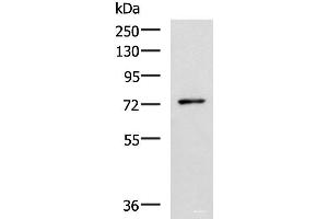 Western blot analysis of Mouse thymus tissue lysate using L3MBTL2 Polyclonal Antibody at dilution of 1:1000 (L3MBTL2 Antikörper)