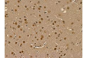 IRAK1 Mouse Monoclonal Antibody at 1/100 staining rat brain tissue by IHC-P.