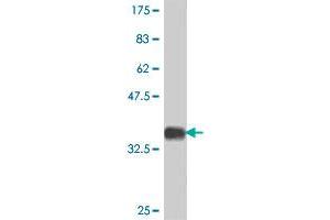 Western Blot detection against Immunogen (37 KDa) . (SCMH1 Antikörper  (AA 404-502))