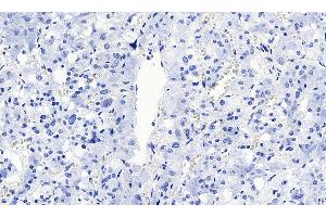 ABIN5855385 Negative Control showing staining of paraffin embedded Human Lung, with no primary antibody. (SLC18A2 Antikörper)