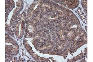Image no. 1 for anti-V-Ets Erythroblastosis Virus E26 Oncogene Homolog 2 (ETS2) (AA 90-349) antibody (ABIN1491702) (ETS2 Antikörper  (AA 90-349))