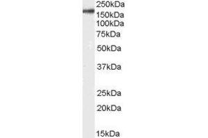 ABIN2563481 (0. (CD11b Antikörper  (Internal Region))
