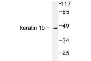 Image no. 1 for anti-Keratin 19 (KRT19) antibody (ABIN265499) (Cytokeratin 19 Antikörper)