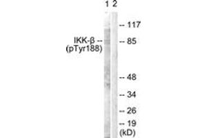 Western blot analysis of extracts from COS7 cells, using IKK-beta (Phospho-Tyr188) Antibody. (IKBKB Antikörper  (pTyr188))