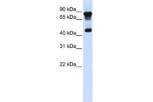 WB Suggested Anti-MAZ Antibody Titration:  0. (MAZ Antikörper  (N-Term))