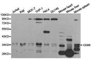Western Blotting (WB) image for anti-CD86 (CD86) antibody (ABIN1871657) (CD86 Antikörper)
