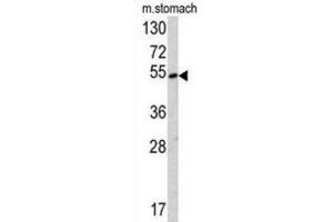 Western Blotting (WB) image for anti-Suppressor of Variegation 4-20 Homolog 2 (SUV420H2) antibody (ABIN2913413) (SUV420H2/KMT5C Antikörper)