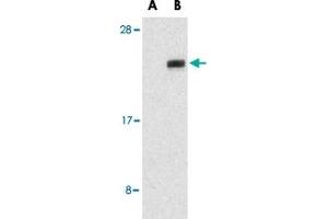 Western blot analysis of NGFRAP1 in human brain tissue lysates with NGFRAP1 polyclonal antibody  at 1 ug/mL in the presence (A) or absence (B) of blocking peptide.