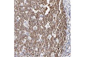 Immunohistochemical staining of human tonsil with NCAPH polyclonal antibody  shows cytoplasmic positivity in reaction center cells. (NCAPH Antikörper)