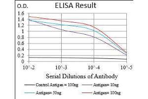 Black line: Control Antigen (100 ng), Purple line: Antigen(10 ng), Blue line: Antigen (50 ng), Red line: Antigen (100 ng), (CD36 Antikörper  (AA 30-130))