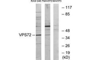 Western Blotting (WB) image for anti-Vacuolar Protein Sorting 72 Homolog (S. Cerevisiae) (VPS72) (AA 131-180) antibody (ABIN2879153) (VPS72 Antikörper  (AA 131-180))