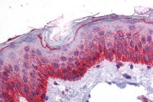 Human Skin: Formalin-Fixed, Paraffin-Embedded (FFPE) (BMP7 Antikörper  (AA 165-214))