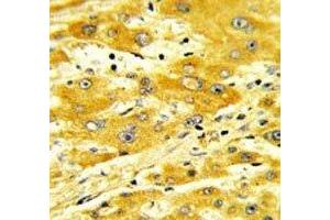 Immunohistochemistry (IHC) image for anti-CD36 (CD36) (AA 213-242) antibody (ABIN3030387)