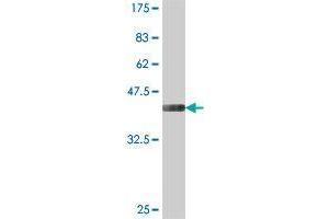 Western Blot detection against Immunogen (37. (GALNT9 Antikörper  (AA 138-237))