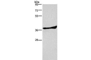 Western Blot analysis of Human fetal liver tissue using AMPK gamma1 Polyclonal Antibody at dilution of 1:300 (PRKAG1 Antikörper)