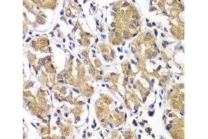 Immunohistochemistry of paraffin-embedded Human gastric using DGKE Polyclonal Antibody at dilution of 1:100 (40x lens).