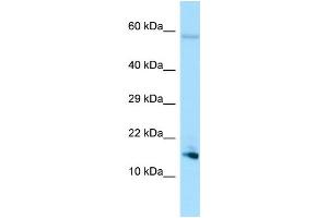 WB Suggested Anti-SPEM1 Antibody Titration: 1. (SPEM1 Antikörper  (N-Term))
