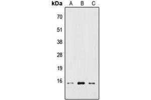 Western blot analysis of RPS19BP1 expression in HEK293T (A), Raw264. (RPS19BP1 Antikörper  (Center))