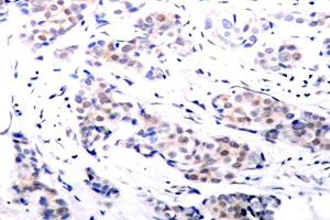 Image no. 2 for anti-ELK1, Member of ETS Oncogene Family (ELK1) antibody (ABIN265398) (ELK1 Antikörper)