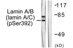 Western blot analysis of extracts from HeLa cells, using Lamin A/C (Phospho-Ser392) Antibody. (Lamin A/C Antikörper  (pSer392))