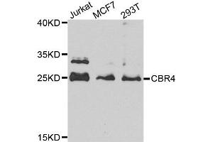 Western blot analysis of extract of various cells, using CBR4 antibody. (CBR4 Antikörper)