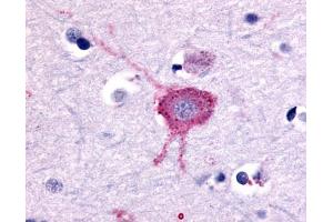 Anti-GRM2 / MGLUR2 antibody IHC of human brain, neurons and glia. (GRM2 Antikörper  (N-Term))