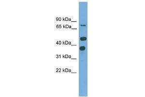 WB Suggested Anti-PTPN11 Antibody Titration: 0.