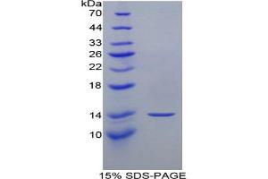 SDS-PAGE analysis of Mouse MFAP5 Protein. (MFAP5 Protein)