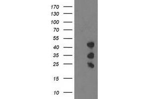 Western Blotting (WB) image for anti-PDZ and LIM Domain 2 (PDLIM2) antibody (ABIN1500129) (PDLIM2 Antikörper)