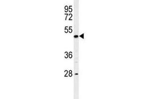 Western blot analysis of RIPK3 antibody and K562 lysate. (RIPK3 Antikörper  (AA 489-518))