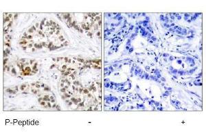 Image no. 2 for anti-V-Rel Reticuloendotheliosis Viral Oncogene Homolog B (RELB) (pSer552) antibody (ABIN197017) (RELB Antikörper  (pSer552))