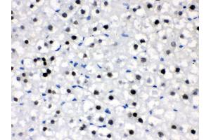 Anti- CRY2 Picoband antibody,IHC(P) IHC(P): Rat Liver Tissue (CRY2 Antikörper  (N-Term))