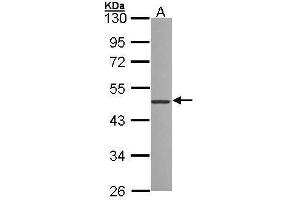 WB Image Sample (30 ug of whole cell lysate) A: 293T 10% SDS PAGE antibody diluted at 1:1000 (ZNF277 Antikörper)