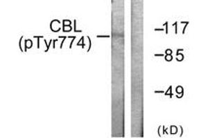 Western blot analysis of extracts from HeLa cells treated with EGF 200ng/ml 30', using CBL (Phospho-Tyr774) Antibody. (CBL Antikörper  (pTyr774))