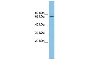WB Suggested Anti-SENP2 Antibody Titration: 0. (SENP2 Antikörper  (Middle Region))
