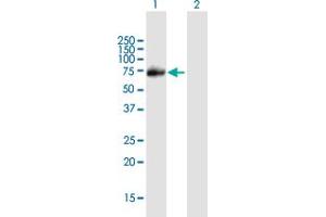 Western Blot analysis of PIAS1 expression in transfected 293T cell line by PIAS1 MaxPab polyclonal antibody. (PIAS1 Antikörper  (AA 1-651))