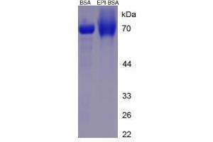 Image no. 1 for Epinephrine/Adrenaline (EPI) protein (BSA) (ABIN1880106)