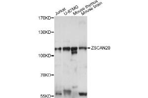 Western blot analysis of extracts of various cell lines, using ZSCAN20 antibody (ABIN6291081) at 1:1000 dilution.